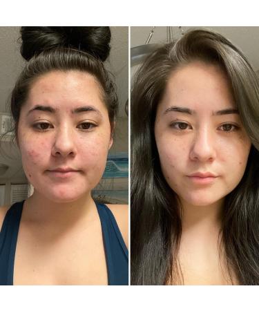 ACTIVE SKIN DETOX - 100% Natural Bentonite Clay Facial & Body Mask for Blemishes Oily Skin Detox & Blackheads - 4 FL. OZ. - Shop Internationally - Buy Online on GoSupps.com