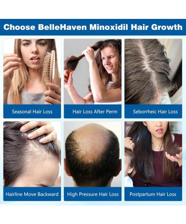 Buy 5% Minoxidil Hair Growth Treatment Spray - 100ML for Men & Women | Hair Regrowth Serum for Thinning & Hair Loss | 2 Month Supply for Beard & Hair - Buy Online on GoSupps.com