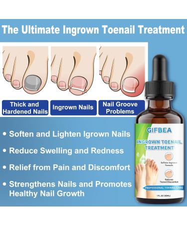 Ingrown Toenail Treatment Kit | Drops Softener & Double-Sided Pedicure Tool for Easy Care | Perfect Solution for Thick Nails & Nail Pain Relief - Buy Online on GoSupps.com