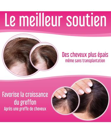 XPECIA hair loss tablets for women blocks DHT new formula for hair growth - Buy Online on GoSupps.com