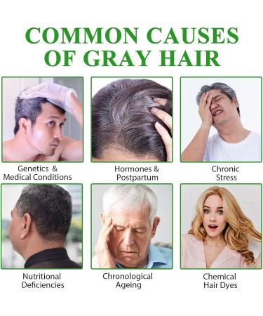  Generisch Dark Brown Herbal Shampoo for Grey Hair Coverage Natural Color for Men and Women - Buy Online on GoSupps.com