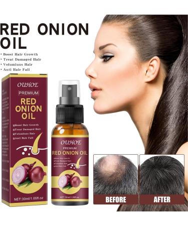 Onion Hair Thickening Spray - 30ml Onion Oil Hair Anti Loss Spray | Red Onion Hair Oil For Hair Regrowth Strengthening Hair Roots And Follicles | Pure Onion Oil Spray For Hair Thickening - Buy Online on GoSupps.com