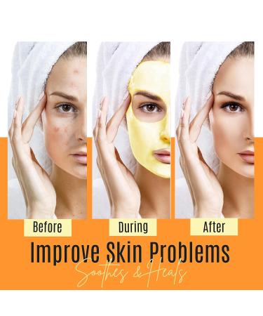 Turmeric Face Mask - Organic Acne Treatment & Anti-Aging Set of 3 | Boost Circulation & Revitalize Dull Skin - Buy Online on GoSupps.com
