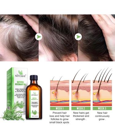 100% Pure Rosemary Oil for Hair Growth, Skin Care & Scalp Nourishment - 3.5 Oz Bottle - Aromatherapy & Hair Loss Treatment for Men & Women - Buy Online on GoSupps.com
