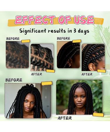 immetee Braid Sheen Spray Rinse-Free Braid Shampoo Brume tress e nettoyante hydratante l'arbre th et l'olive Anti-dandruff Itch relief formula 250ml/8.79 fl.oz - Buy Online on GoSupps.com