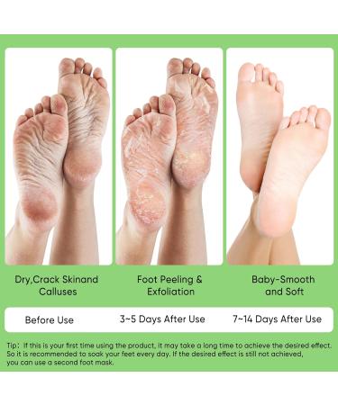 Masque Pieds Exfoliant 3 Paires Soin pour Pieds Secs Talons Fendus Callosit s Retire la Peau Morte Pieds Doux Spa la Maison ou Voyage(Aloe Vera) - Buy Online on GoSupps.com
