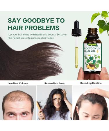 Natural Polygonum Multiflorum Hair Essential Oil | Nourish Scalp Strengthen Roots & Promote Hair Growth for Men & Women - Buy Online on GoSupps.com