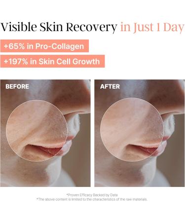 Laboreve PeachMicrobiome 78 PDRN Toner & 84 EGF Serum | 2 Step Skin Barrier Repair & Anti-Aging | Niacinamide Hyaluronic Acids Collagen | Boost Firmness Radiance Deep Moisture | Korean Skin Care - Buy Online on GoSupps.com