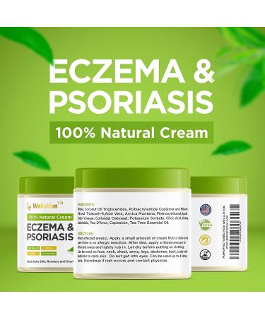 WELLUTION Natural Eczema and Psoriasis Cream - Intensive All-in-1 Treatment for Skin Irritations - Made in USA - Buy Online on GoSupps.com