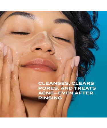 Murad Acne Control Clarifying Cleanser Salicylic Acid & Green Tea Formula for Acne Deep Pore Cleansing Oil Control & Breakout Prevention for Clear Balanced Healthy-Looking Skin 5 Fl Oz (Pack of 1) - Buy Online on GoSupps.com