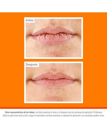  O'Keeffe's O'Keeffe's Lip Repair SPF 15 Lip Balm for Dry and Chapped Lips 24 Hours Hydration - Buy Online on GoSupps.com