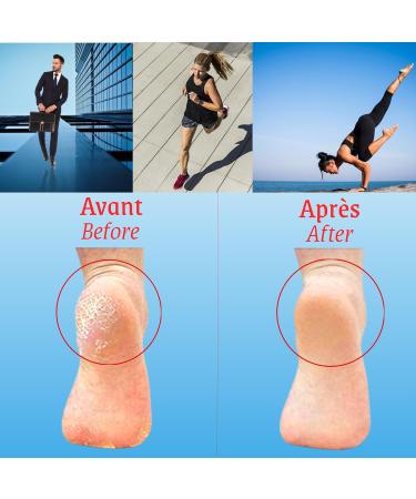 Buy Silicone Heel Protection - Anti-Bubble Socks & Moisturizing Sleeves for Heel Pain Relief | Unisex SeBS Gel Quality - Buy Online on GoSupps.com