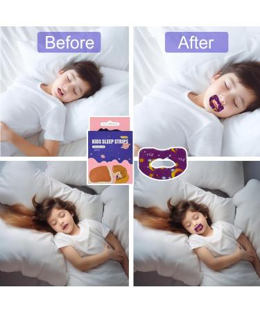 Mouth Tape for Sleeping - Promote Nasal Breathing Quit Mouth Breathing (Kid's Size 90 Sheets) - Skin Friendly & Cute Pattern - Buy Online on GoSupps.com