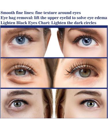 Instant Firming Eye Cream Instant Eye Lift Eye Tightening Lifting Serum Tightener Eye Bag Cream Temporary Eye Tightener Eye Cream for Dark Circles and Puffy Eyes Eye Bag Remover Eye Bag Eraser - Buy Online on GoSupps.com