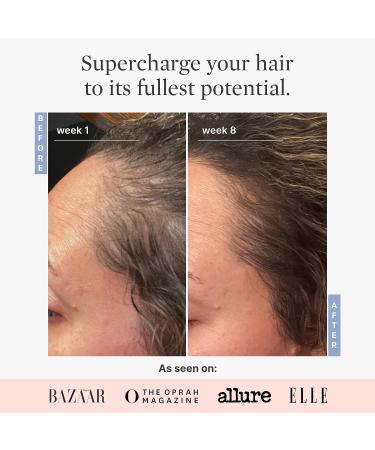 Better Not Younger Superpower Advanced Duo - Hair Densifying Scalp Serum & Massaging Applicator for Stronger, Thicker-Looking Hair - 2 fl.oz - Buy Online on GoSupps.com