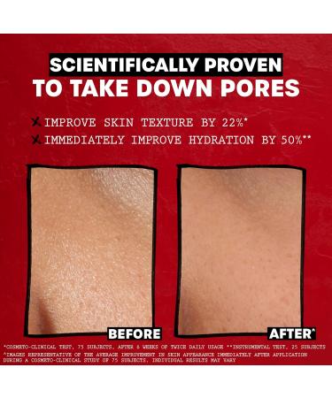 Thayers Rose Petal Witch Hazel Facial Toner with Aloe Vera - 12 Fl Oz (Pack of 1) - Buy Online on GoSupps.com