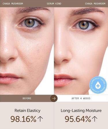 Radiance&Hydration Vitamin C with Sea Buckthorn Oil Chaga Mushroom Extract Serum-Korean Skincare Set for Brightening&Deep Hydration Vegan & Cruelty-Free 1.04fl oz. - Buy Online on GoSupps.com