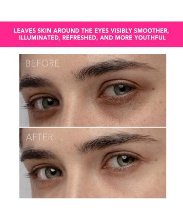 Foreo Iris Illuminating Eye Massager for Puffy Eyes & Dark Circles | Eye Bags Remover | Enhances Cream Absorption | Ultra-Hygienic Silicone | Antiaging Care - Buy Online on GoSupps.com