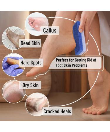 Slick Pumice Stone for Feet Callus Remover - 4 Pack, 2 Colors | Foot Scrub for Pedicure and Dead Skin Removal - Buy Online on GoSupps.com