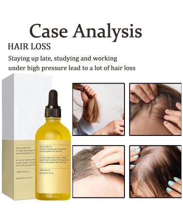 Veganic Hair Oil Set - Natural Rosemary Oil for Hair Growth | Nourishes & Strengthens Thin Brittle Hair - Buy Online on GoSupps.com