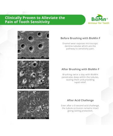 Biomin F Toothpaste 75ml - 4 Pack | Natural Remineralization & Fluoride for Healthy Teeth - Buy Online on GoSupps.com