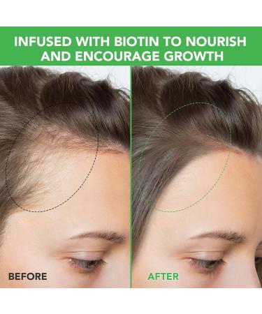  CUZZYDUNJYNN Rosemary routine shampoo for hair growth routine shampoo for women with hair loss and thinning hair with biotin nourishing smooth shampoo for men and - Buy Online on GoSupps.com