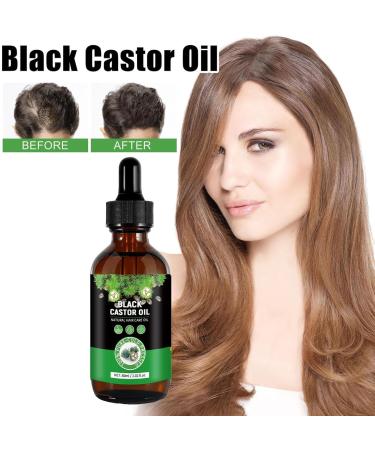 Castor Oil for Hair - Castor Oil Cold Pressed | Natural Hair Growth Oil with Castor | Strengthening Nourishing Hair Regrowth Oil | Hair Thickening Oil 30ml Promotes Longer Thicker Hair - Buy Online on GoSupps.com