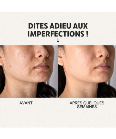  O l na Moisturizing face cream with salicylic acid. Treatment for dark spots blackheads and acne scars. 50 ml - Buy Online on GoSupps.com