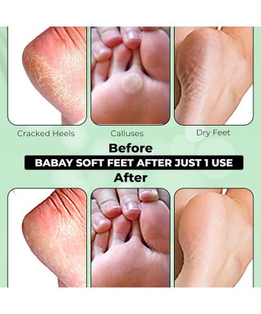 Foot Peel Mask (2 Pairs) - Exfoliating Foot Care for Smooth, Baby Soft Skin - Remove Dead Skin, Lavender Gel for Men and Women - Aloe Vera Foot Spa Treatment - Buy Online on GoSupps.com