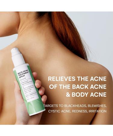 Tea Tree Oil Back Acne Treatment - 2% Salicylic Acid Body Solution for Teens - 4.05 Ounce - Buy Online on GoSupps.com