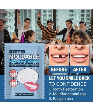 Tooth Repair Kit Temporary Tooth Repair Kit Teeth Repair Kit for Missing Tooth Temporary Teeth Replacement Kit Moldable False Teeth Cavity Filler for Teeth Temporary Filling for Tooth - Buy Online on GoSupps.com