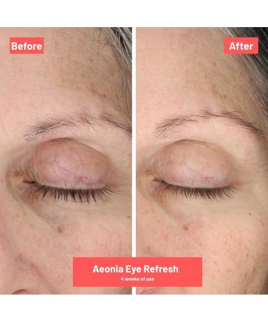 Aeonia Eye Refresh - Certified Space Technology Skincare Hydrating & Age-Defying Eye Cream w/ Bacillus Lysate Reduces Fine Lines Puffiness & Dark Circles Firming & Illuminating Formula 0.5 Fl Oz - Buy Online on GoSupps.com