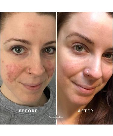 True Botanicals CLEAR Repair Nightly Treatment Serum | Non-Toxic Cruelty-Free Anti-Aging Serum | Hyaluronic Acid for Blemishes & Wrinkles | MADE Safe - 1 fl oz | International Shipping Available - Buy Online on GoSupps.com