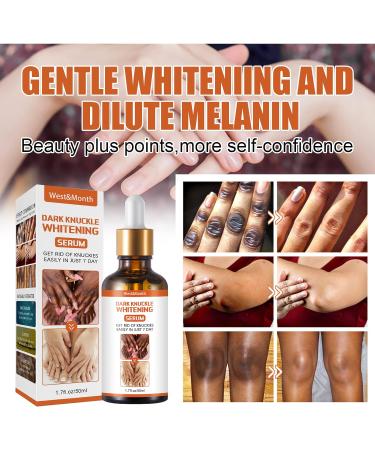Whitening Serum Hand Knuckle Glow Serum - 2PCS, 1.7 Fl Oz - Restoring Treatment for Dark Knuckle Elbow - Moisturizing & Exfoliating Formula for Brighter, Firmer Skin - Buy Online on GoSupps.com