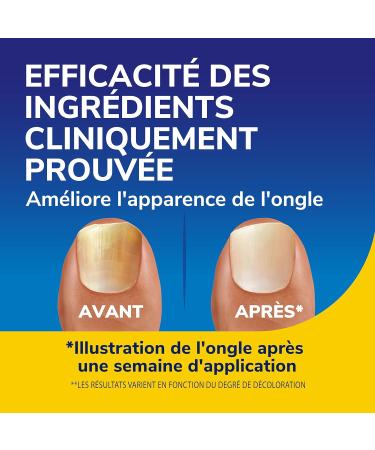 Dr. Scholl's S rum revitalisant ongles jaunis 10 ml - R sultats visibles d s 2 jours -Triple action : lisse claircit et hydrate - Am liore l'aspect des ongles des mains et pieds ab m s par la mycose - Buy Online on GoSupps.com