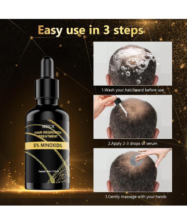 MGLIMZ 5% Minoxidil - Hair Growth Oil for Men & Women | Extra Strength Beard & Hair Regrowth Treatment for Thicker Fuller Hair - Buy Online on GoSupps.com