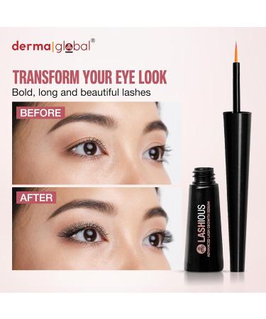 Derma Global LASHious Advanced Lash Growth Serum | Multi-Peptide Complex with Anagain Biotin Panthenol & Caffeine Red Clover Flower Extract | Prostaglandin-Free & Non-Irritating Formula | 3mL - Buy Online on GoSupps.com