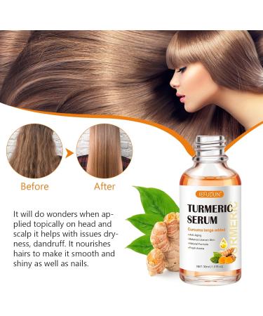 Turmeric Serum for Dark Spots Removal Turmeric Dark Spot Corrector Serum for Face & Body Turmeric Oil Age Spot Corrector Skin Care Moisturizing Serum - Buy Online on GoSupps.com