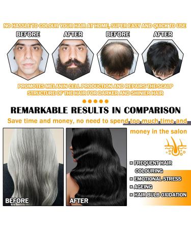 Black Hair Dye Shampoo for Gray Hair | Long Lasting 3 in 1 Hair Color for Men & Women - Buy Online on GoSupps.com