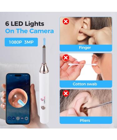 CLARITYEARS Ear Wax Removal Kit with Camera 1080P HD 6 LED Otoscope Ear Cleaner Earwax Removal Tool with App USB-C Rechargeable Ear Cleaning Kit for Adults and Kids - Buy Online on GoSupps.com