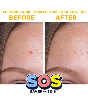 Fun Shape Blemish Patches | Fast Acting Hydrocolloid Acne Treatment | Vegan & Latex-Free | International Shipping Available - Buy Online on GoSupps.com