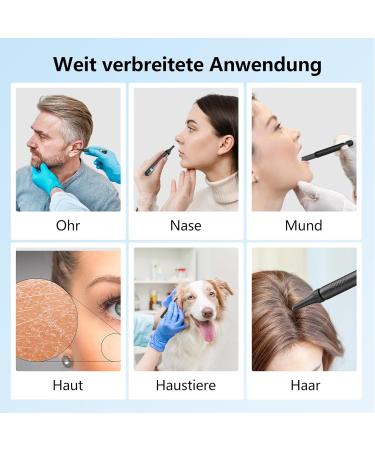 1080p WiFi Ear Wax Removal Otoscope | IP67 Waterproof Ear Cleaner Camera | 360 Wide Angle Endoscope with 6 LEDs for iPhone iPad & Android - R1+ Black - Buy Online on GoSupps.com