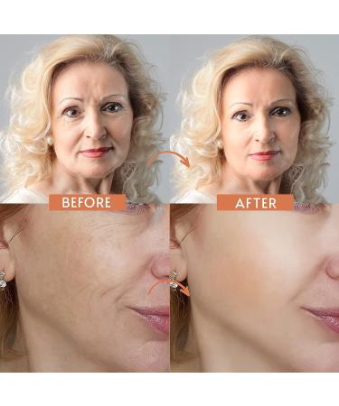 Navabelle Premium Face Wrinkle Patches - Forehead & Anti Wrinkle Tape for Fine Lines (192 PCs) - Buy Online on GoSupps.com