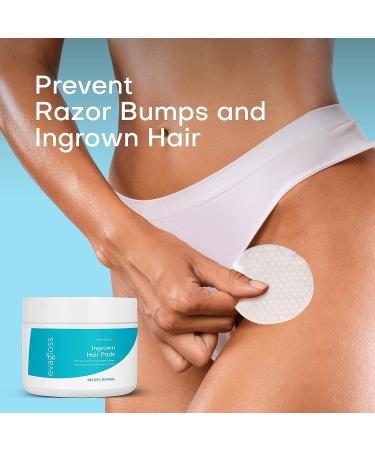 Ingrown Hair Treatment Pads 50 Count - Topical Daily Treatment for Razor Burn, Bumps, After Shave, Waxing - Bikini Bump Blaster, Prevents Ingrown Hairs, Soothes Irritation - Buy Online on GoSupps.com
