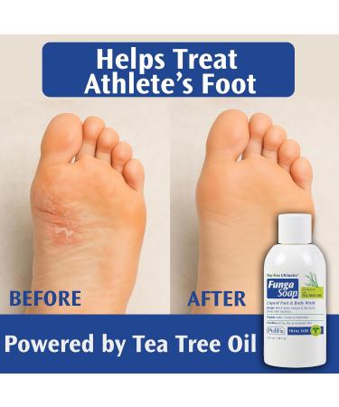 Pedifix FungaSoap Tea Tree Oil Foot & Body Wash 2 oz (Travel Size) Small Bottle for Itchy Skin, Odor & Fungus Care Perfect for On-the-Go Use Same Formula as Larger Sizes Tea Tree 2 Fl Oz (Pack of 1) - Buy Online on GoSupps.com
