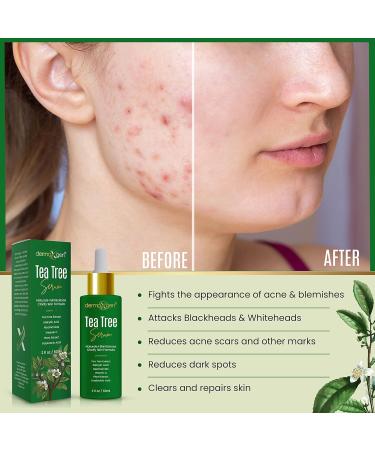 DERMAXGEN Instant Face Lift Cream & Tea Tree Serum Lightweight Skincare Duo with Botanical Ingredients for a Smoother Refreshed Look - Buy Online on GoSupps.com