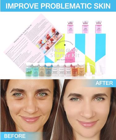 Kybbe Foundation Liquid for Needling System Semi Permanent Base Concealer Waterproof Glow (C) - Buy Online on GoSupps.com