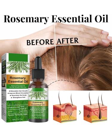 Plant-Based Rosemary Hair Oil 120ml - Essential Oil for Hair Growth & Skin Care | Nourish Scalp & Stimulate Growth for Men & Women - 4PCs - Buy Online on GoSupps.com