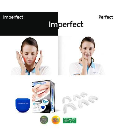 The ConfiDental - Pack of 6 Moldable Mouth Guard for Teeth Grinding Clenching Bruxism  Sport Athletic  Whitening Tray - Buy Online on GoSupps.com