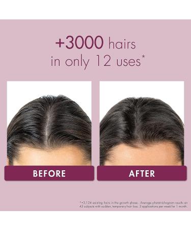 Klorane Strengthening Serum with Quinine and Edelweiss - Thicker, Stronger Hair for Men and Women - 3.3 Fl Oz - Paraben, Silicone, Sulfate Free - Buy Online on GoSupps.com